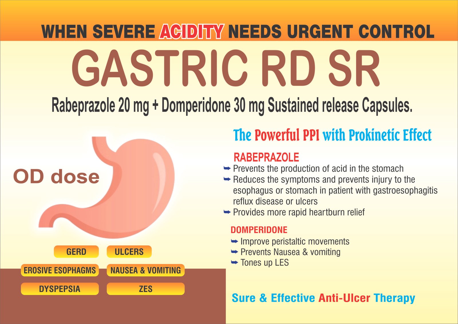 GASTRIC RD SR Capsules | Rabeprazole 20 mg + Domperidone 30 mg