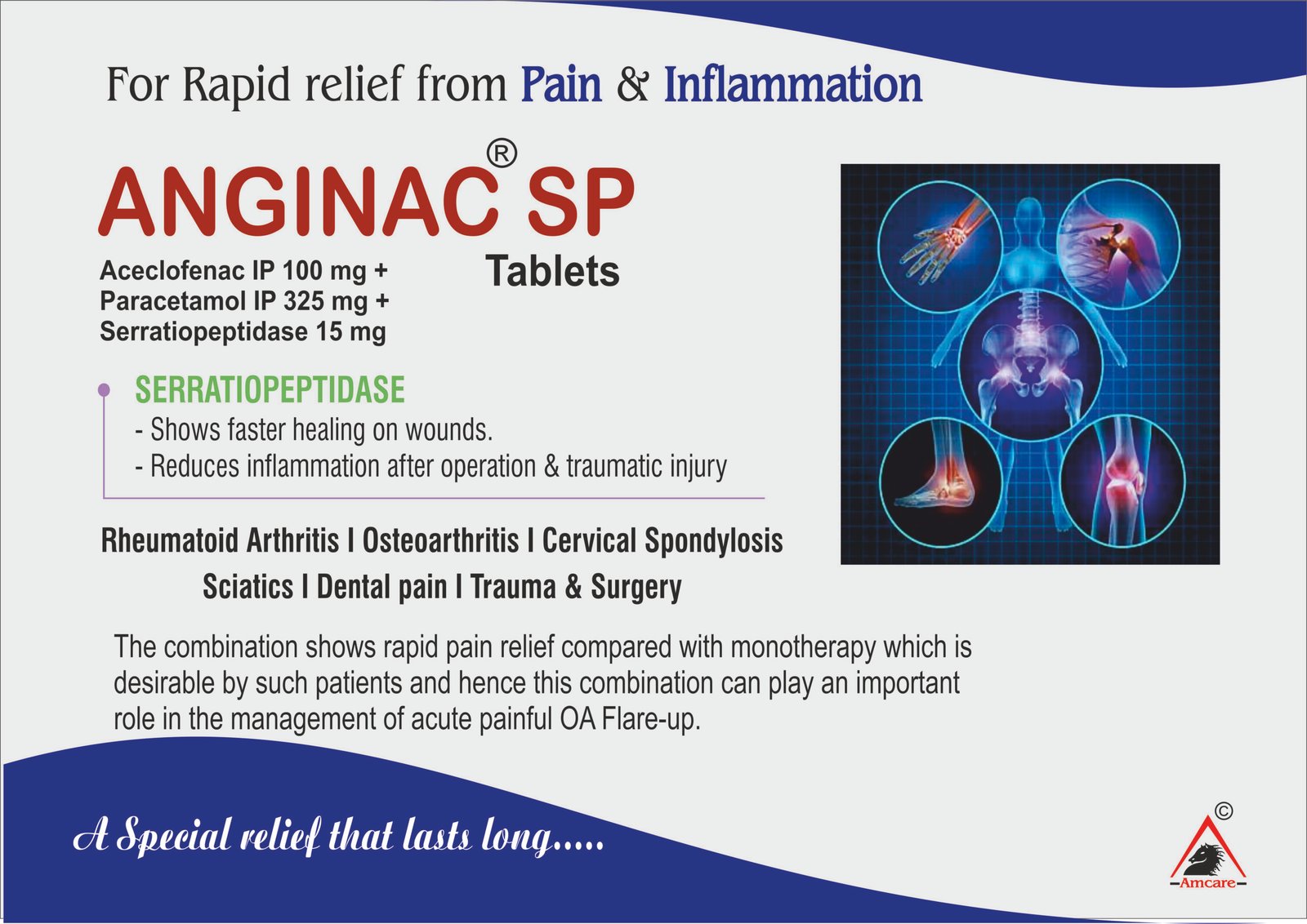 ANGINAC-SP Tablets – Aceclofenac + Paracetamol + Serratiopeptidase